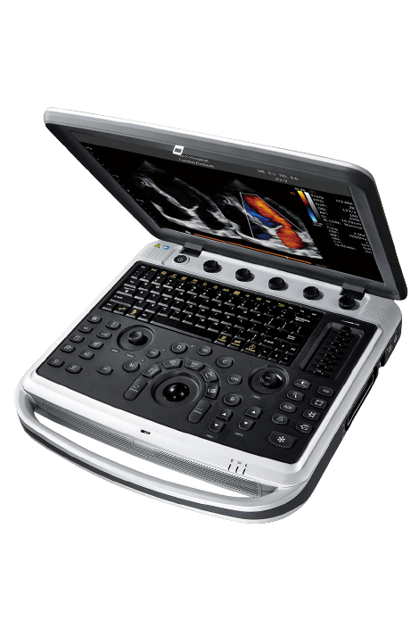 Узи-аппарат Chison SonoBook 8