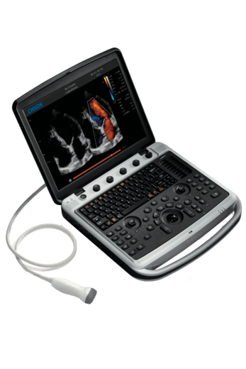 Узи-аппарат Chison SonoBook 9 3