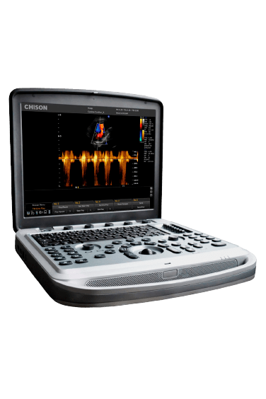 Узи-аппарат Chison SonoBook 8 3