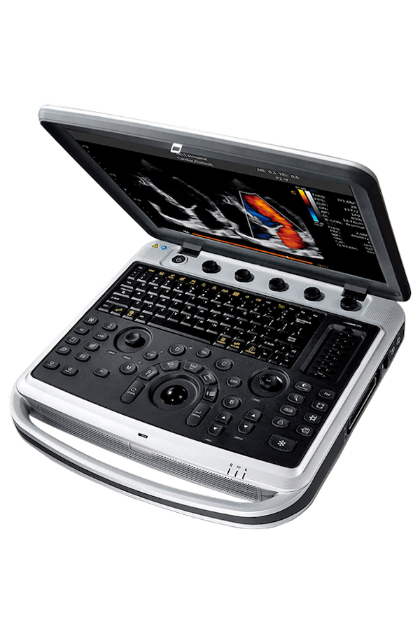 Узи-аппарат Chison SonoBook 9 1