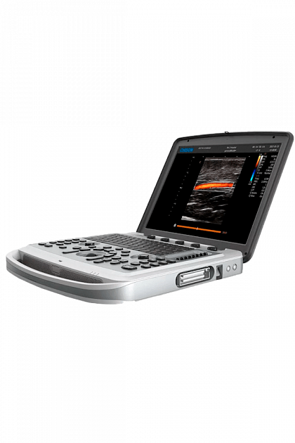 Узи-аппарат Chison SonoBook 6 1