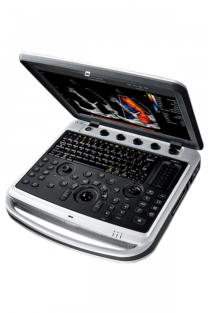 Узи-аппарат Chison SonoBook 9 1